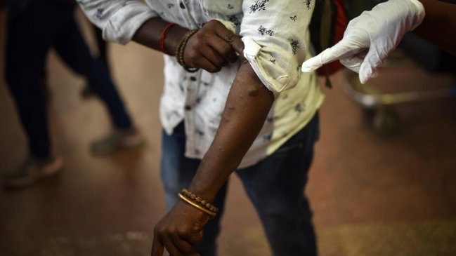 OMS recuerda que la vacuna contra viruela del mono tarda semanas en inmunizar