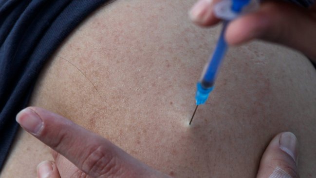 África no ha recibido todavía ninguna vacuna contra la viruela del mono