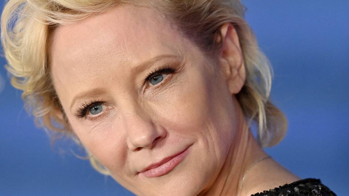 Anne Heche fue declarada con muerte cerebral tras accidente automovilístico