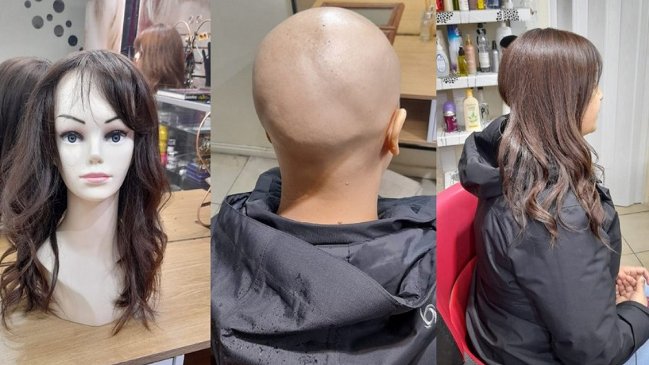 Hospital de Temuco invita a donar cabello para pelucas destinadas a pacientes oncológicas