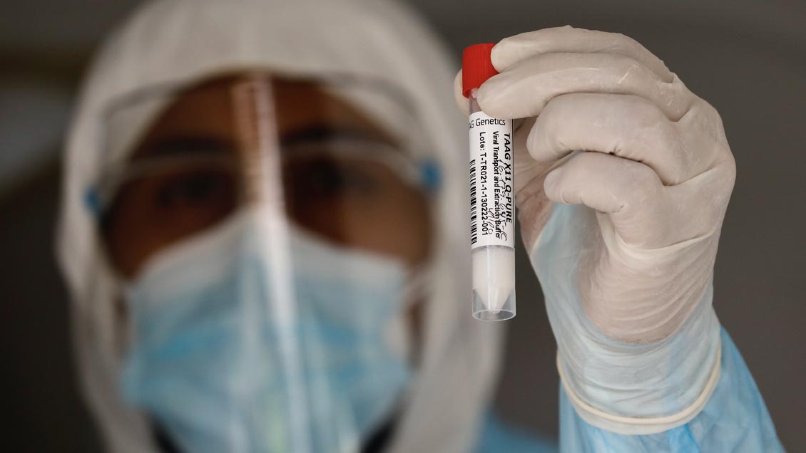 Casos nuevos de Covid siguen a la baja: Se han reducido 39% en las últimas dos semanas