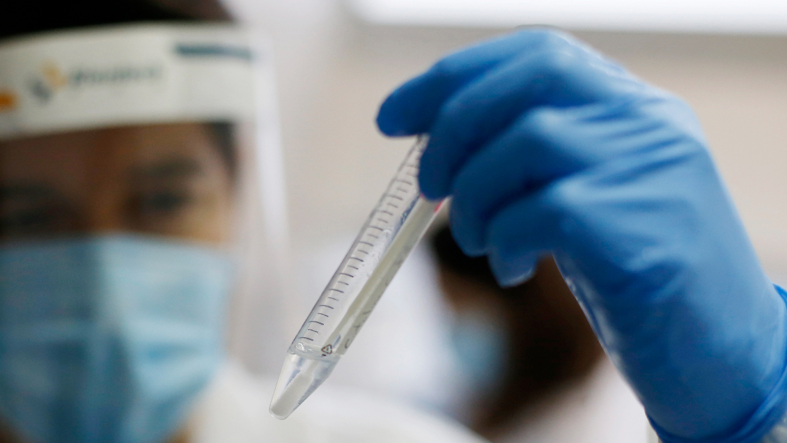 Seremi de Salud reportó primer caso de viruela del mono en Arica