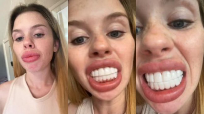 Joven gastó 200 mil pesos para tener la 