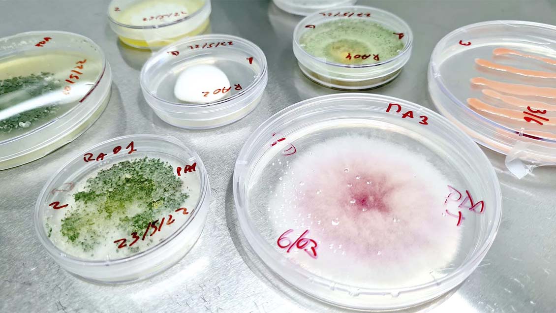 Científicos chilenos buscarán en la Antártica hongos que controlen el Alzheimer