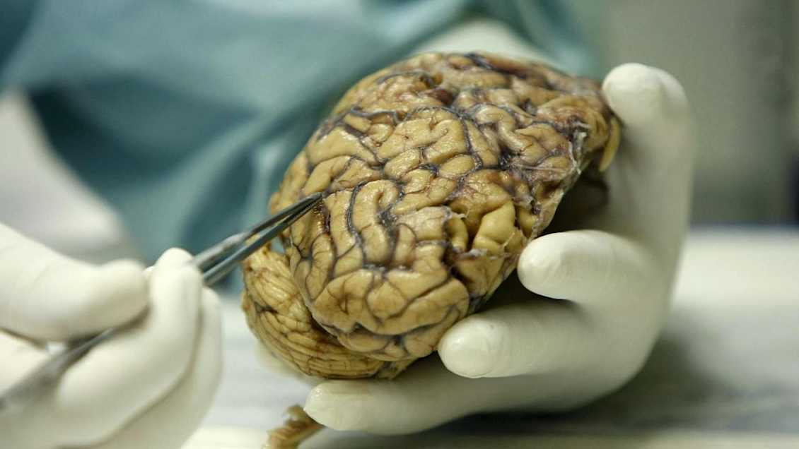 Expertos de Iberoamérica unen fuerzas para crear la Universidad de Alzheimer