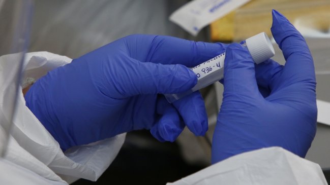 Covid-19: Minsal reportó 2.977 casos nuevos y una positividad de 15,1 por ciento