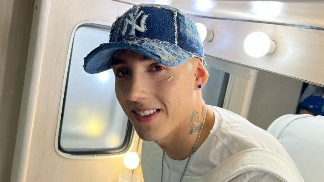 Pailita se alejó de las redes sociales por una infección a los ojos