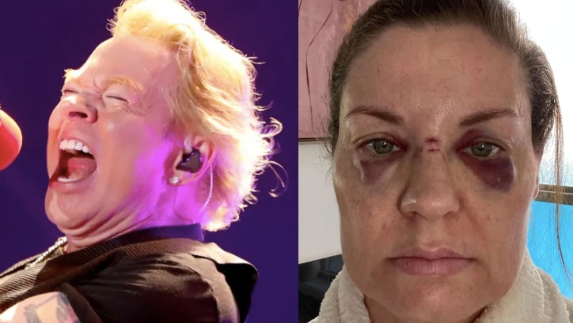 Tras herir a fan, Axl Rose dejará de lanzar micrófono en shows de Guns N' Roses: 