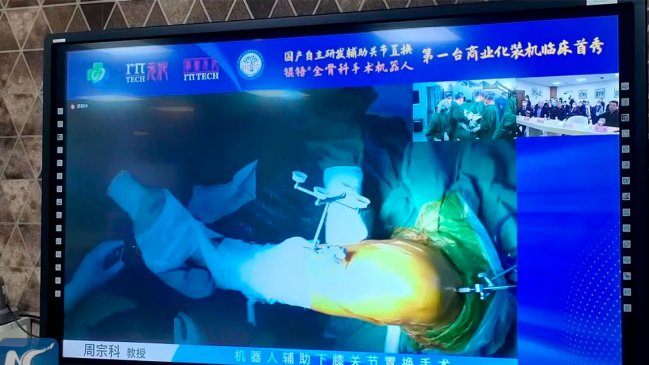 Robot desarrollado por China realiza primera cirugía de reemplazo de rodilla