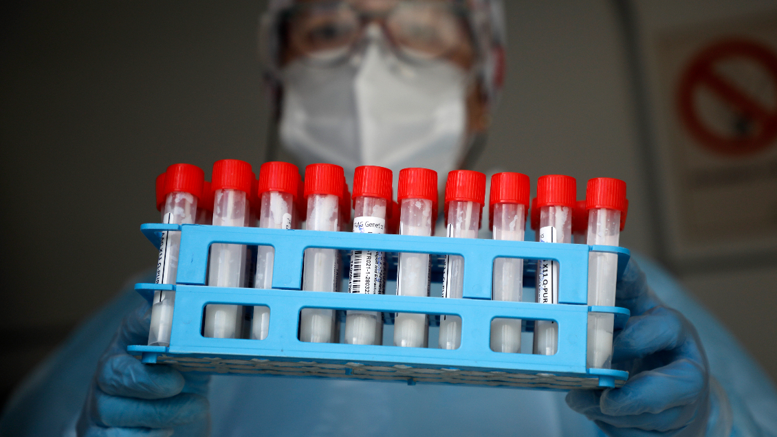 Reporte Covid-19: Minsal informa 2.593 casos nuevos y positividad superior al 16%