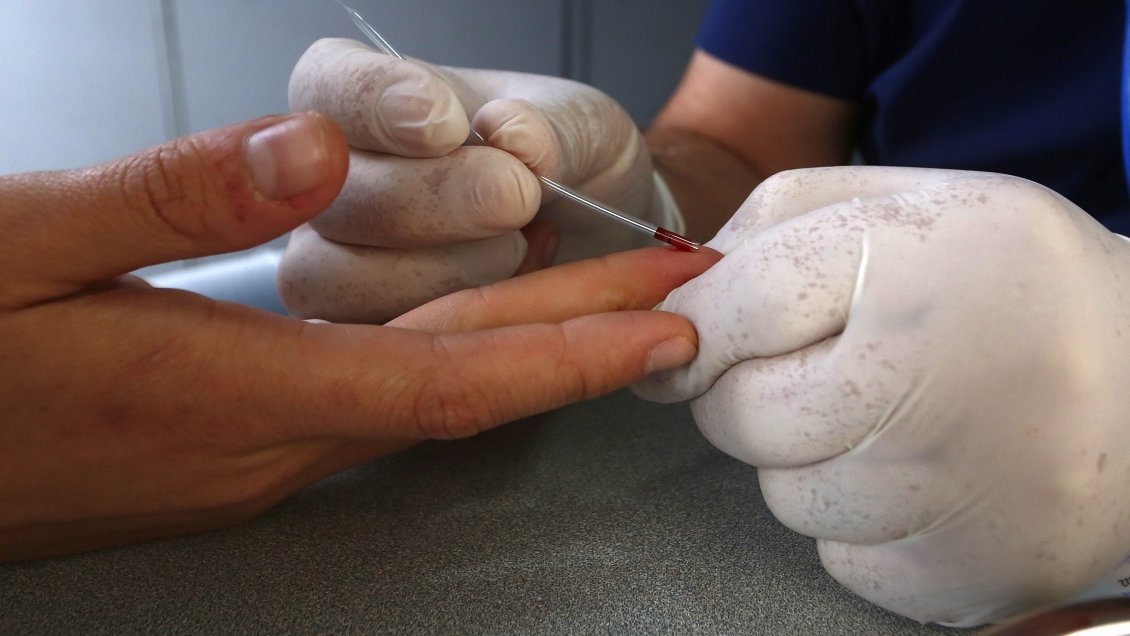 Confirman tercer paciente del mundo que se cura del VIH