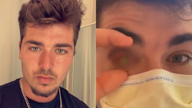 Joven quedó ciego tras dormir una siesta de 40 minutos: 