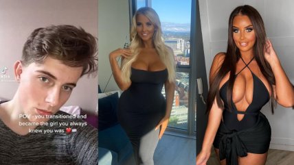 Mujer transgénero gastó 100 millones de pesos en cirugías