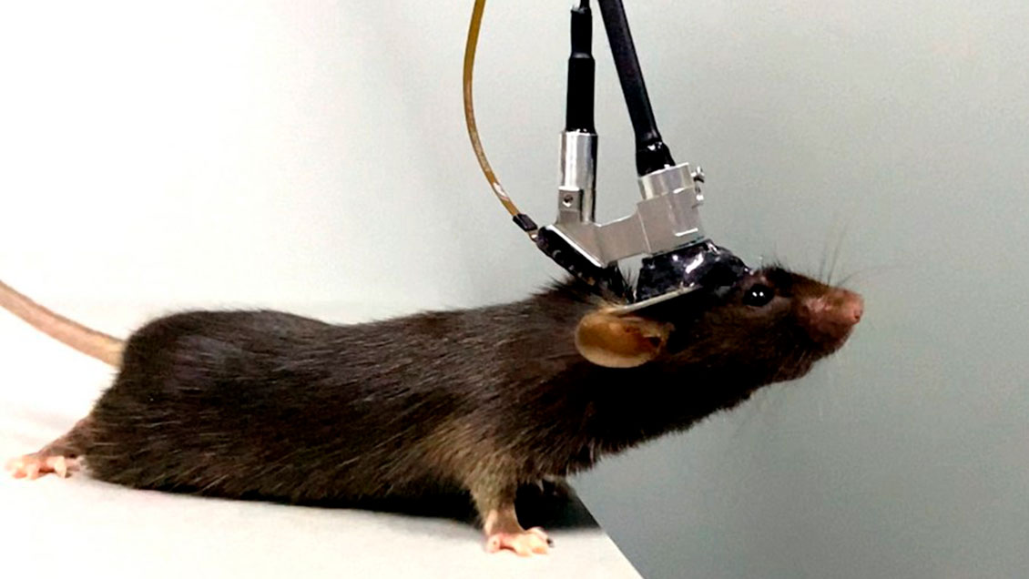 China crea microscopio de tres fotones para imágenes del cerebro profundo