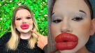   Mujer con los labios más grandes del mundo busca batir un nuevo récord con sus mejillas 