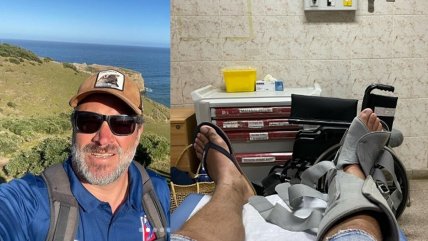   Vacaciones: Sebastián Sichel intentó mariscar y se fracturó una pierna 
