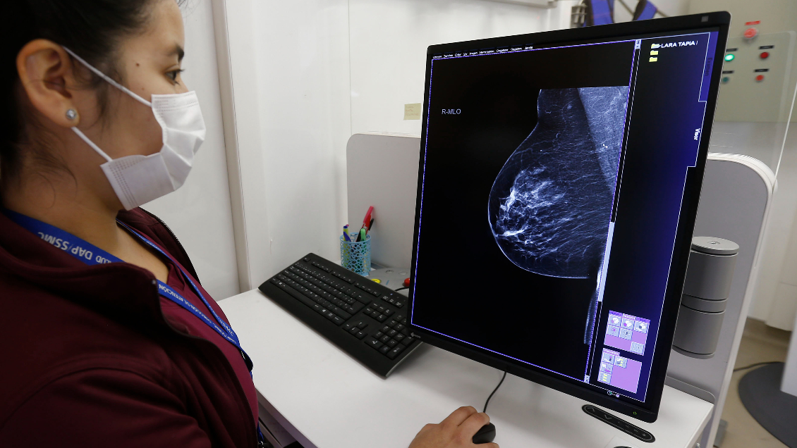 Avanza proyecto que exime de orden médica las mamografías preventivas