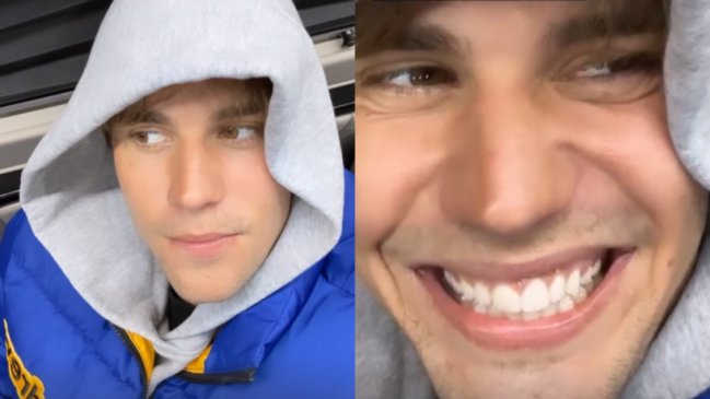 Volvió a sonreír: Justin Bieber mostró su recuperación de la parálisis facial