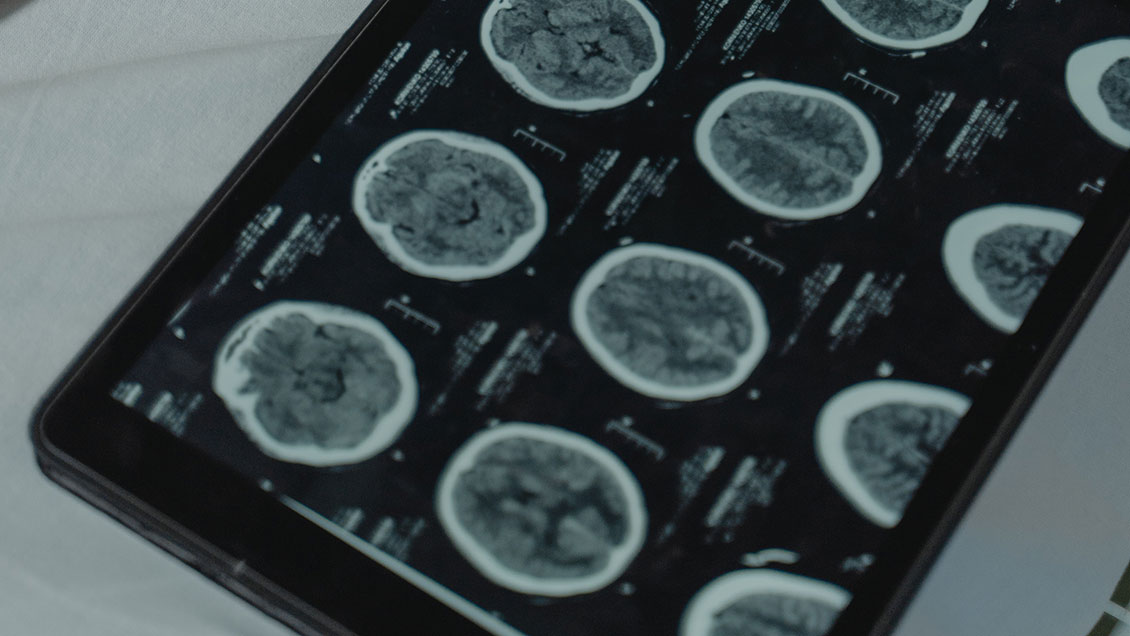 Científicos desarrollan batería implantable que mata células tumorales