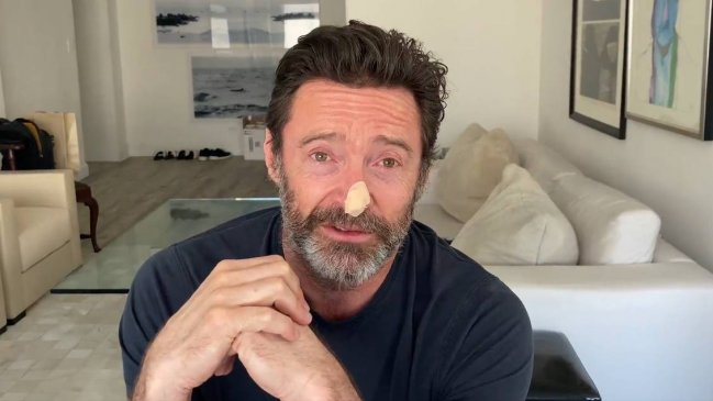 Hugh Jackman se realizó nuevas biopsias ante amenaza de nuevo cáncer de piel