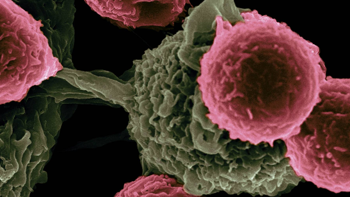 Científicos españoles desarrollan método para diagnosticar cáncer en menos de tres horas