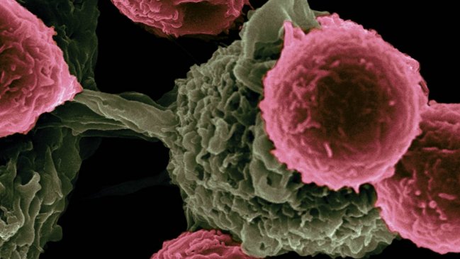 Científicos españoles desarrollan método para diagnosticar cáncer en menos de tres horas