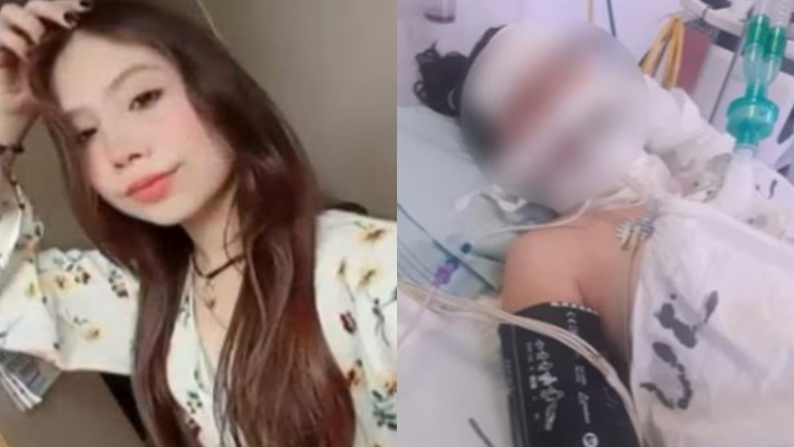 Joven de 20 años fue dentista a sacarse una muela y murió