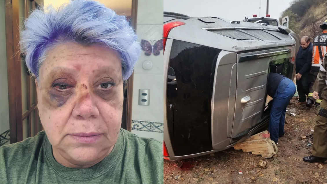 Patricia Maldonado dio detalles de su accidente: 