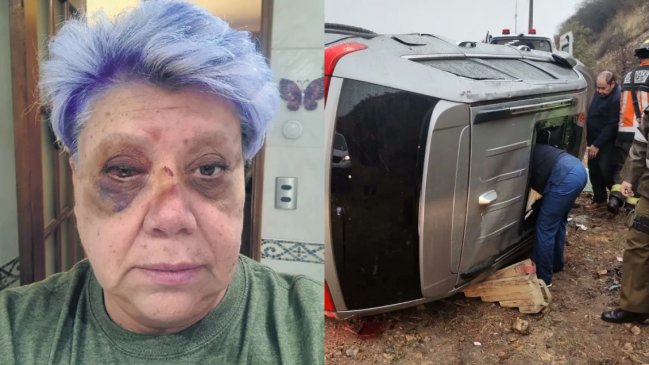 Patricia Maldonado dio detalles de su accidente: 