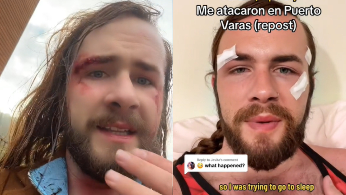 Turista fue víctima de brutal golpiza en Puerto Varas: 