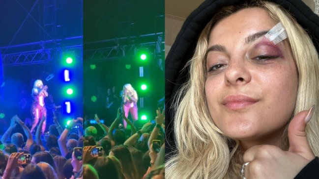 Bebe Rexha se desplomó en el escenario: Celular de fanático impactó en el rostro de la cantante