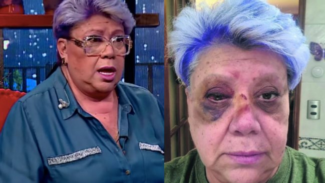 Patricia Maldonado detalla secuelas físicas y psicológicas a dos semanas de sufrir accidente automovilístico