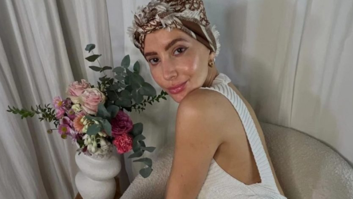 Aylén Milla mostró el crecimiento de su pelo después de numerosas quimioterapias