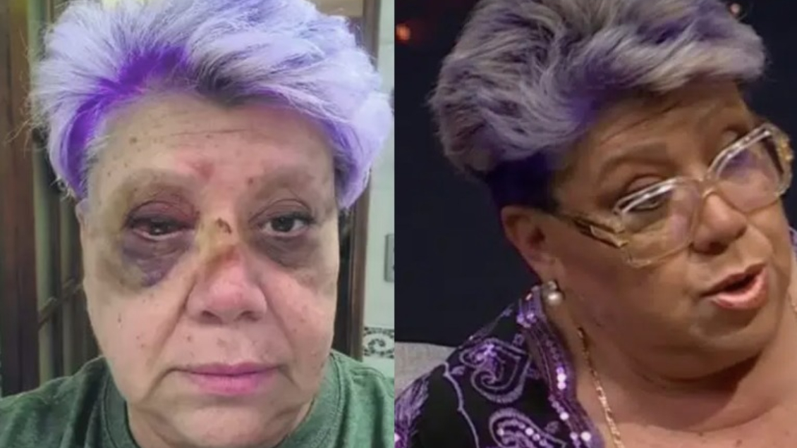 Patricia Maldonado reveló millonaria pérdida tras caótico accidente