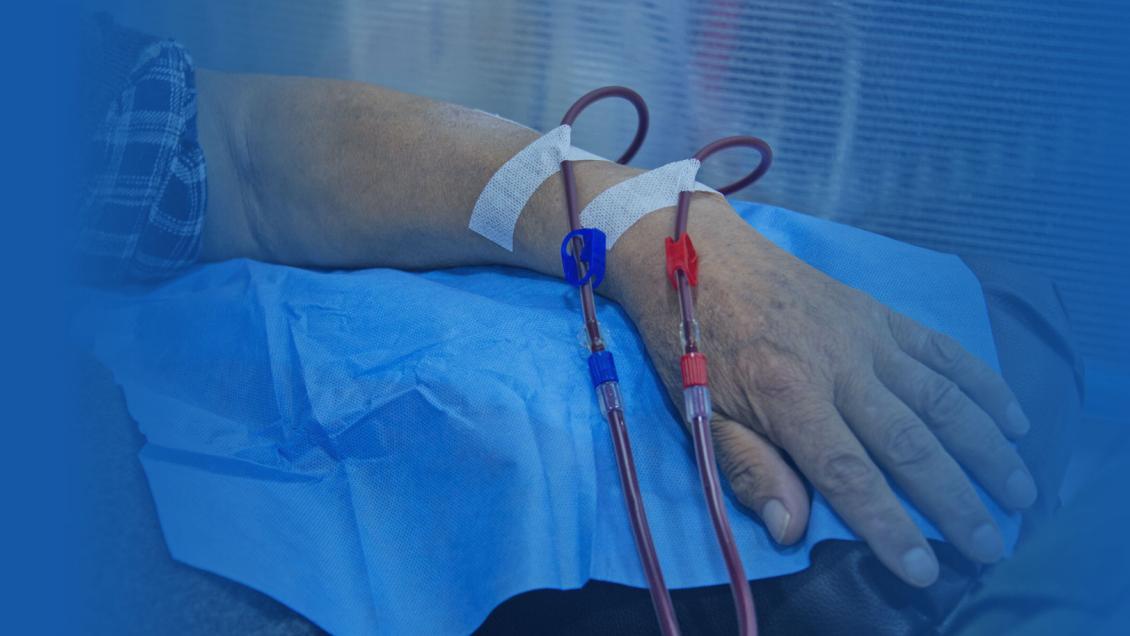 Alertan sobre riesgo cardiovascular de los enfermos renales crónicos