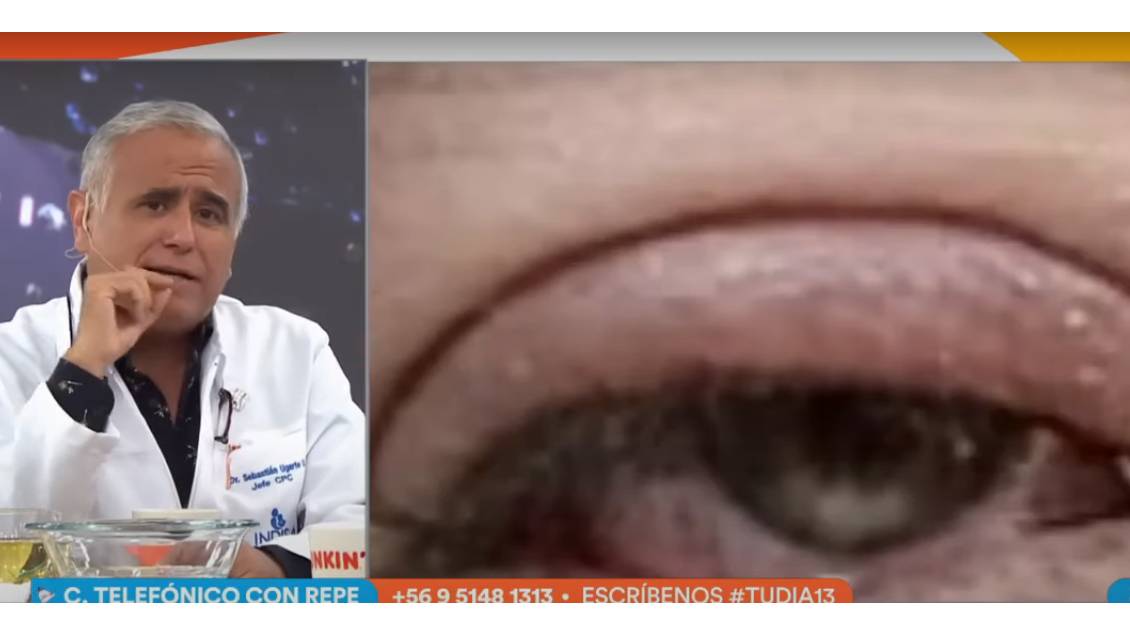 Incómoda infección hizo ausentarse a Repenning de 