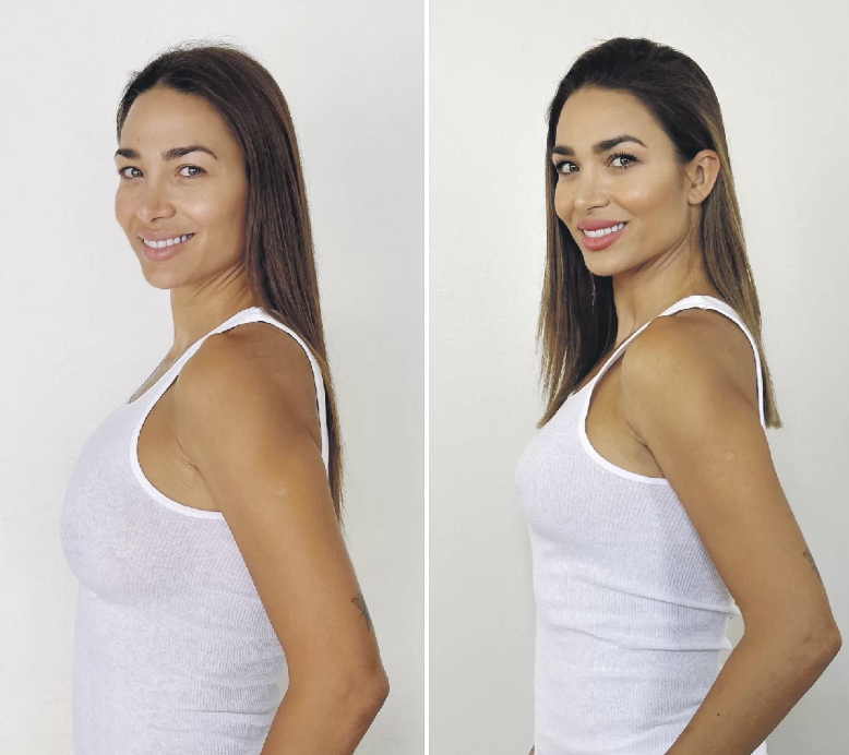 El antes y después de Lisandra Silva