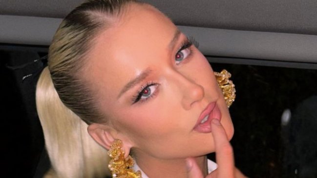 La sincera confesión de Vesta Lugg sobre sus intervenciones estéticas