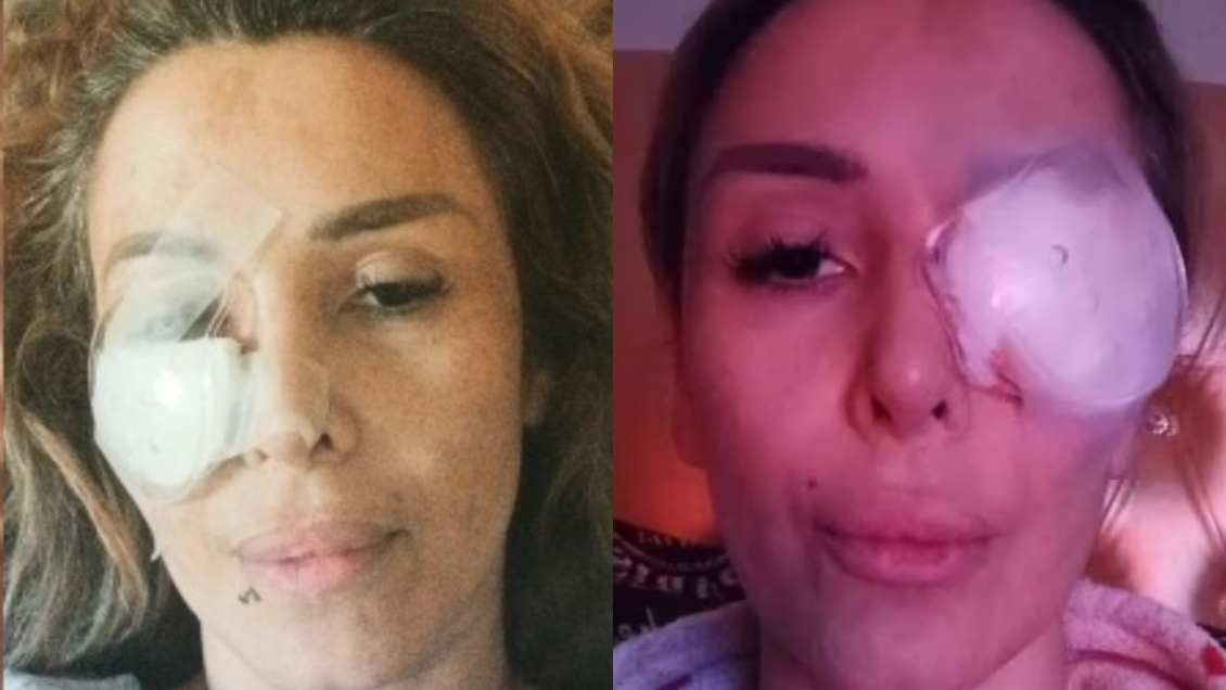 Romina Sáez tras brutal golpiza: 