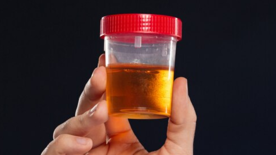 Fin a siglos de misterio: Investigadores descubrieron por qué la orina es amarilla