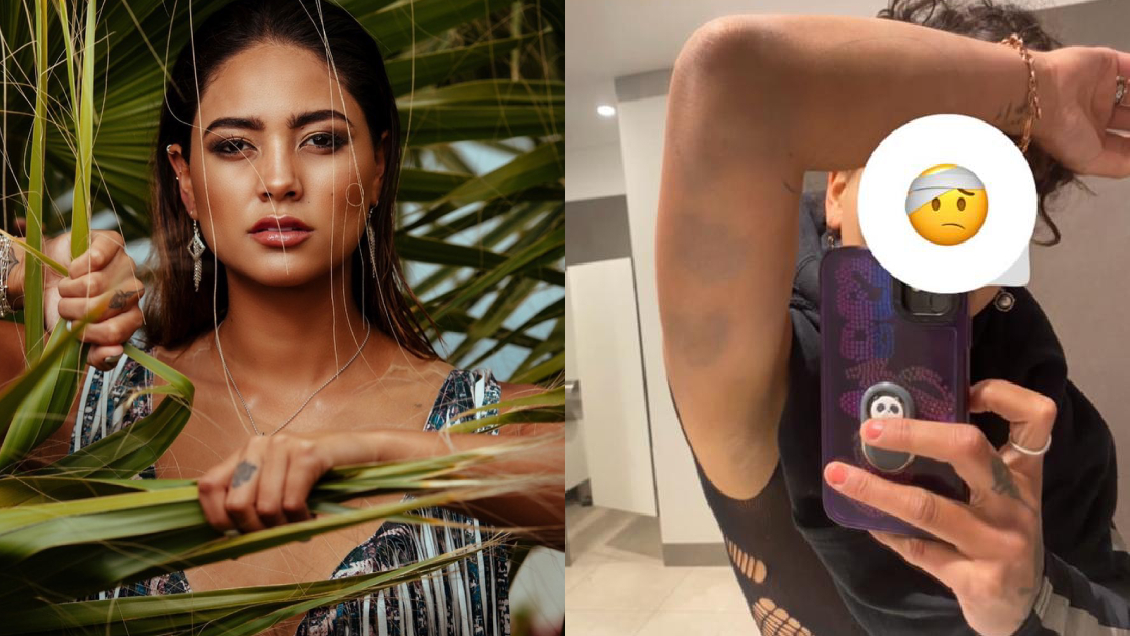 Camila Recabarren detalló agresión de su hermano: 