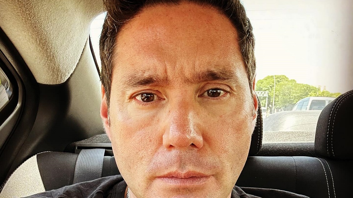 Francisco Saavedra dijo adiós al bótox tras 16 años: 