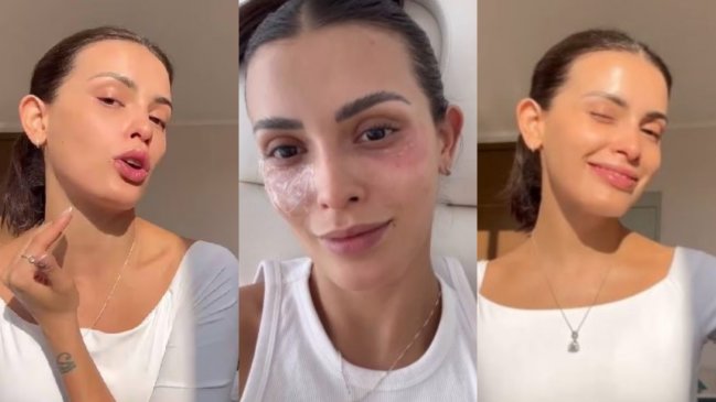 Cony Capelli reveló peculiar tratamiento con ADN de esperma de salmón