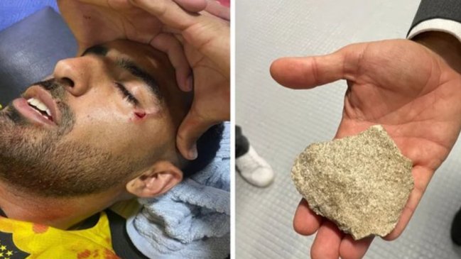 Uruguayo Maxi Olivera fue agredido con una piedra en su rostro por fanático de Rosario Central