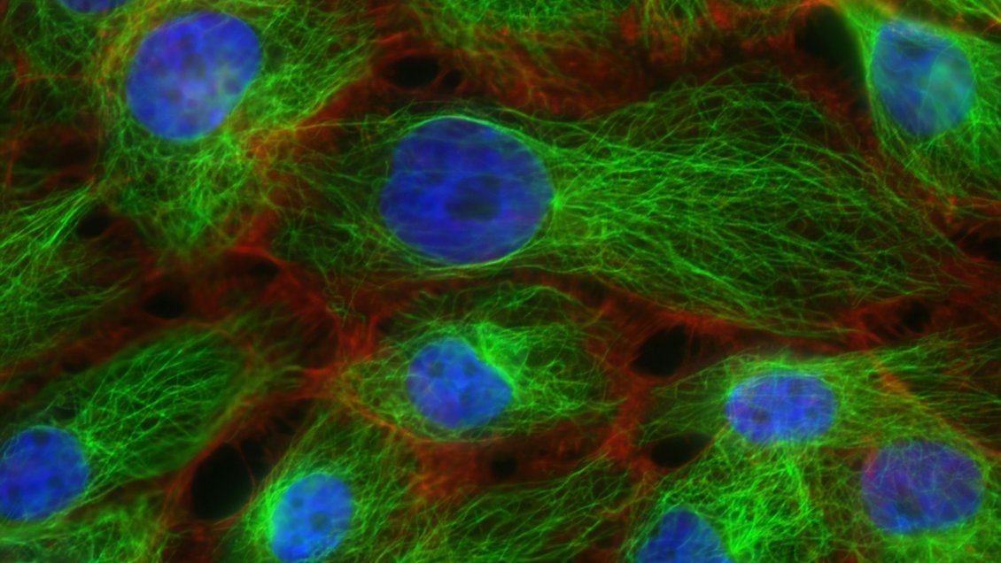 Expertos chinos mejoran detección de cáncer de esófago mediante inteligencia artificial