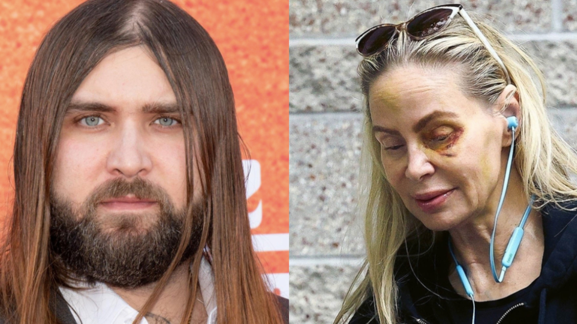 Hijo de Nicolas Cage es acusado de golpear brutalmente a su madre