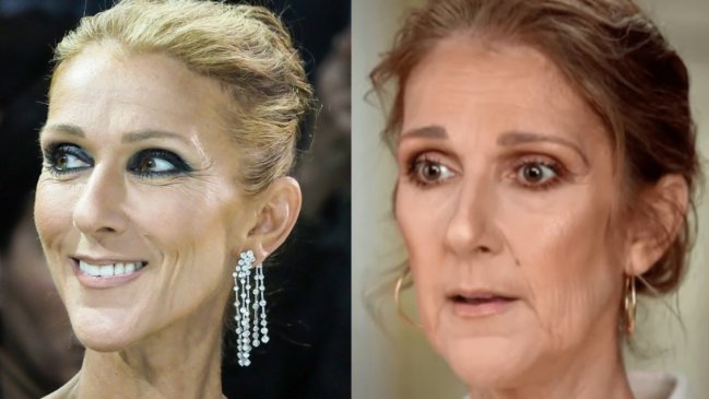 Celine Dion y el calvario por su enfermedad: 