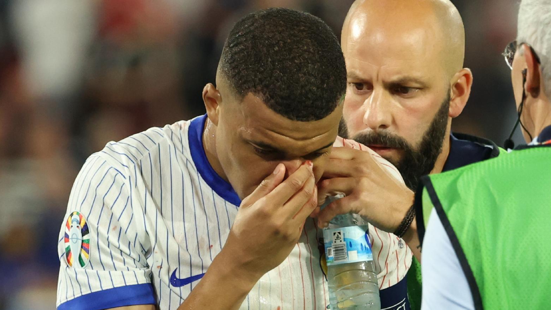 Mbappé se rompió la nariz y fue sustituido ante Austria