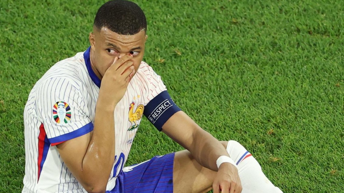 Mbappé pidió consejo a seguidores tras lesión en la nariz: 