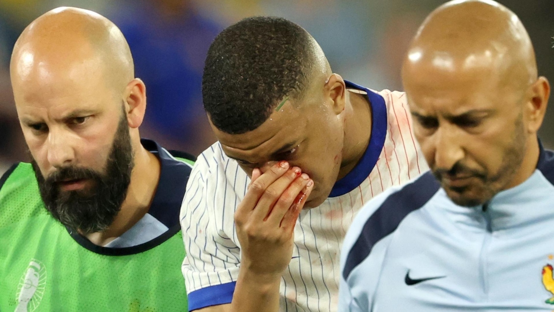 [FOTO] Con los colores de Francia: Kylian Mbappé mostró la máscara que usará en la Euro